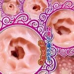 肉壁黏膜連續刃